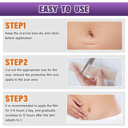 Silicone Scar Sheets, Medical Grade Silicone Scar Tape for Old & New Scars