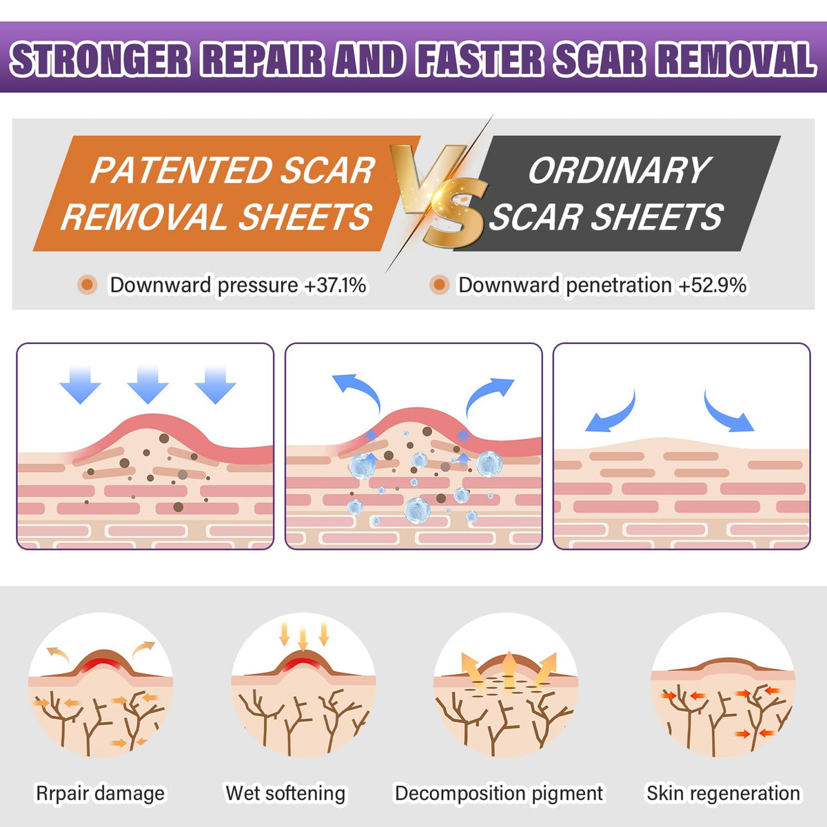 Silicone Scar Sheets, Medical Grade Silicone Scar Tape for Old & New Scars